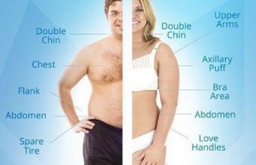 CoolSculpting Center of NYC